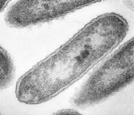 Image of bacterial cells taken through an electron microscope. The image is black and white. One bacterial cell occupies most of the image. Parts of other cells are visible around the edges. Each cell is roughly rod shaped with rounded edges.